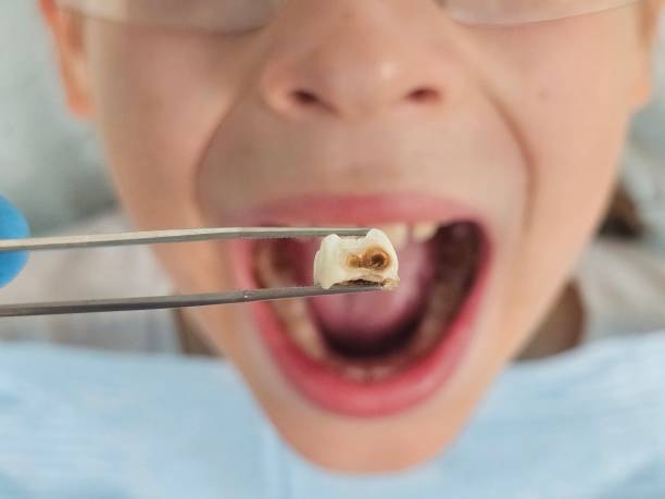 Best Weekend Emergency Dentist in Lake Ripley, WI
